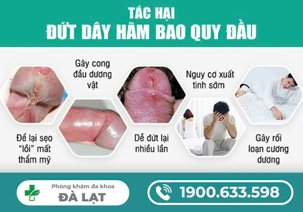 Hình ảnh minh họa